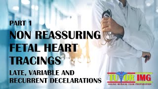 Medical Shots  Non Reassuring Fetal Heart Tracings  Part 1  Tutor IMG [upl. by Faletti]