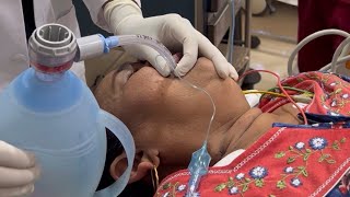 Adult Resuscitation  Cardiopulmonary resuscitation CPR  Video laryngoscope  neet dr raj [upl. by Adella]