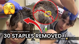 NIDAL IS GETTING STAPLES REMOVED FROM HIS HEAD🫣 Doctor checkup [upl. by Rice]