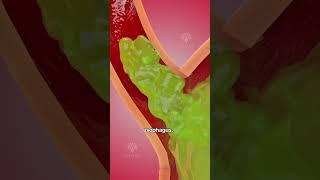 How acid reflux happens 🥵 Acidity and gas problem  GERD shorts viralvideo  creativelearning3d [upl. by Yebba]