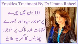 Atni Freckles Treatment at Home  Dr Umee Raheel Tips  100 effective results [upl. by Mandi]