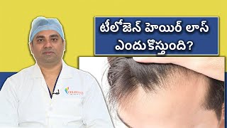 What is Telogen effluvium know here Symptoms Treatment and Recovery  Samayam Telugu [upl. by Ellertal]