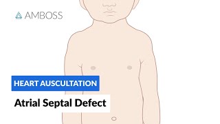 Atrial Septal Defect  Heart Auscultation  Episode 7 [upl. by Fifi556]