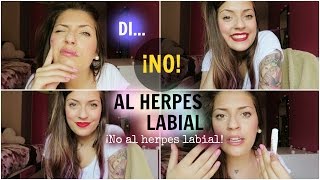 ¿CÓMO DISIMULAR UN HERPES LABIAL ✔ [upl. by Alak751]