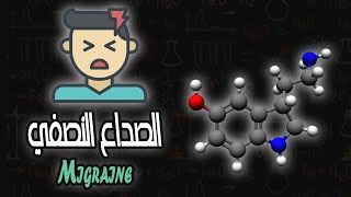 الصداع النصفي  Migraine [upl. by Chaudoin365]