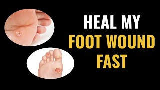 How Do I Heal My Foot Wound Fast  Introduction [upl. by Jenny]