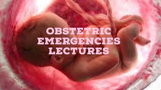 OBSTETRIC EMERGENCIES lecture 2 POST PARTUM HEMORRAHGE all important points [upl. by Nnaylloh]