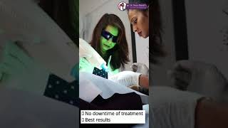 Freckles Treatment by Dermatologist  How to Get Rid of Freckles  Dr Naiya Bansal [upl. by Millman]