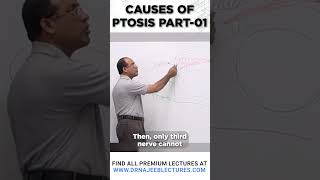 Causes Of Ptosis Part 01 drnajeeblectures drnajeeb shortvideo [upl. by Gomar]