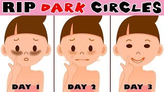 Get Rid of Dark Circles Fast Permanently Under Eye Home Remedy Urdu Hindi [upl. by Gawen203]