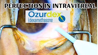 How to give intravitreal Ozurdex  Exercise right protocols from the beginning [upl. by Masao]