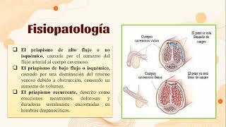 Priapismo [upl. by Sheena]