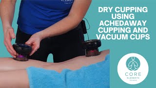 Clinical Dry Cupping with Achedaway and Vacuum Cups [upl. by Hudis687]