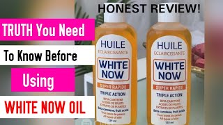 What you need to know about WHITE NOW OIL before using on your Skin Honest Review [upl. by Romy]