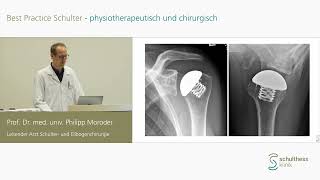 «Wann anatomische wann inverse Endoprothesensysteme»  Prof Philipp Moroder Schulthess Klinik [upl. by Bandur653]