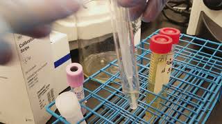 Urinalysis Preparing the 3 patient urine specimens for microscopic analysis [upl. by Laverne266]