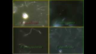 Treponema Syphilis Darkfield Video CDC [upl. by Petracca385]