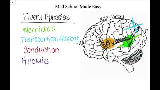 Fluent Aphasias Made Easy How to Distinguish and Remember Them [upl. by Adnaerb]