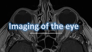 Imaging of the eye [upl. by Skelly]