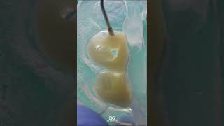 Composite veneers veneers bonding dentistry [upl. by Esirahc]