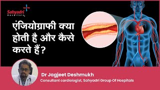 एंजियोग्राफी क्या होती है और कैसे करते हैं  Angiography in Hindi  Dr Jagjeet Deshmukh  Sahyadri [upl. by Colleen]