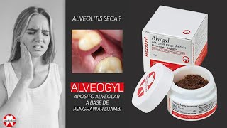 ALVEOGYL Recubrimiento de Alveolitis seca  Septodont [upl. by Eirised]