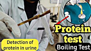 Detection of protein in urine  Protein test in urine  Boiling test  Protein test [upl. by Zeba]