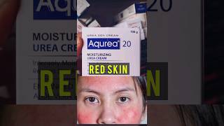 aqurea 20 cream ।। best dry skin cream ।। aqurea 20 moisturizer cream ke fayde [upl. by Pren]