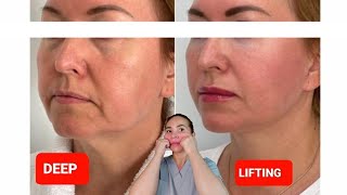 DEEP LIFTING massage  Sagging Jowls  Nasolabial Folds  Double chin [upl. by Adnohsak]