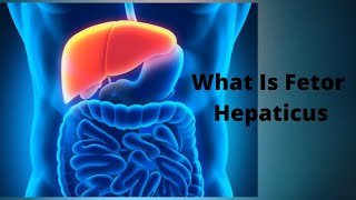 What Is Fetor Hepaticus [upl. by Gent]