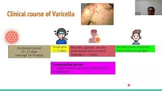 240515 Varicella Zoster virus  Treatment and prevention [upl. by Aenat16]