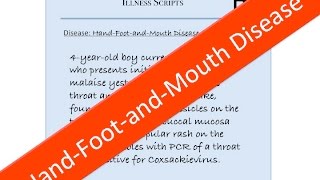 HandFootandMouth Disease Coxsackie Virus Illness Script  USMLE Pediatrics [upl. by Damien]