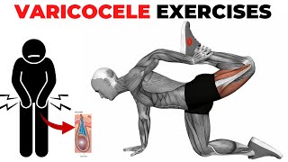 Pelvic Floor Exercises to Treat Varicocele [upl. by Justino]