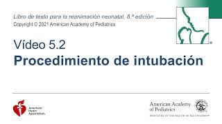 Procedimiento de Intubación Neonatal [upl. by Ahtanoj]