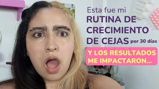 1 Month Eyebrows and Hair Growth Results IM SHOCKED  Minoxidil and Mielle Update [upl. by Lillywhite]