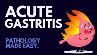 Acute Gastritis Pathology Simplified MUST KNOW [upl. by Annaek778]