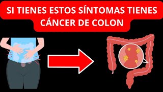 Si tienes Estos Síntomas tienes Cáncer de Colon [upl. by Lauber429]