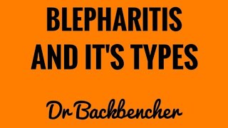 Blepharitis  Types causes clinical features and treatment  Ophthalmology [upl. by Moser]