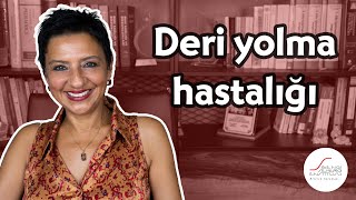 Deri yolma hastalığı [upl. by Oicneserc396]