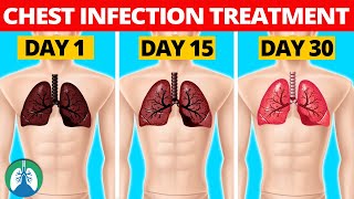 7 Natural Chest Infection Treatments Home Remedies [upl. by Esina]