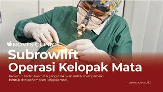 SOLUSI KELOPAK MATA MENGGANGU DEGAN SUBROWIFT NOVIS Dermatology [upl. by Joappa655]