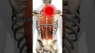 Erector Spinae Trigger Points [upl. by Dreddy]