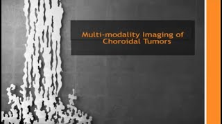 Multimodality Imaging of Eye Tumors How to Make the Diagnosis [upl. by Lilybel]