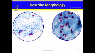 Cryptosporidium Intestinal coccidia [upl. by Noicnecsa]