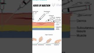 Different route of injection administration of drugs route injection shorts 3danimation viral [upl. by Aerdma]