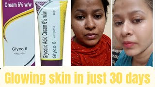 Glyco 6 cream  glycolic acid cream  how to use [upl. by Eltsyrk690]