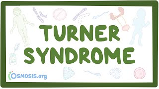 Turner syndrome Year of the Zebra [upl. by Colligan]