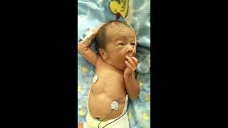 Preemie Baby Stretching in NICU Incubator So Tiny amp Cute [upl. by Etam]