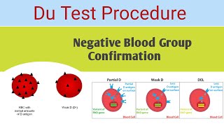 Du blood group  Du blood group procedure  Negative Blood Group Confirmation [upl. by Arihday]