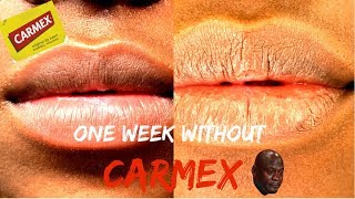 One Week Without CARMEX [upl. by Eellah]